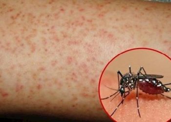 Cách phòng bệnh sốt xuất huyết trong mùa hè