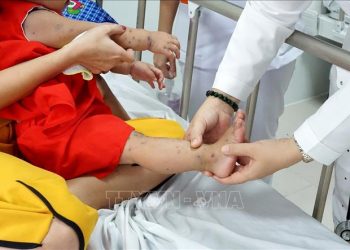 Tây Ninh: Bệnh tay chân miệng tăng 2,5 lần